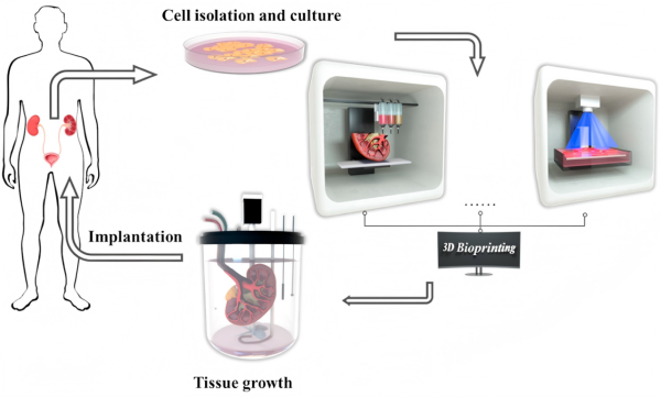 3D生物打印为泌尿疾病打开新赛道
